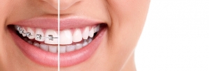 ortodoncia clinica dental fernandez y casquero