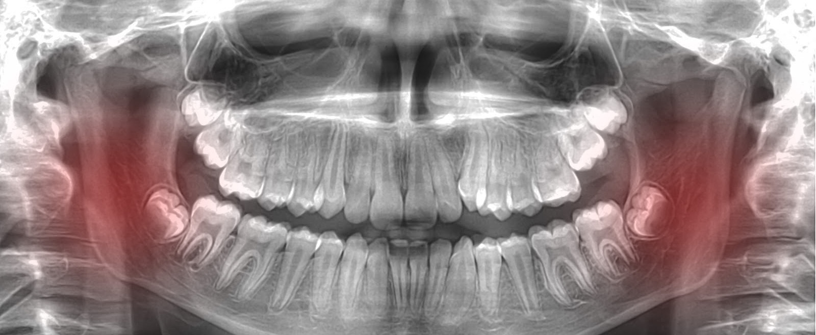 ATM mandibular clinica dental fernandez y fajardo